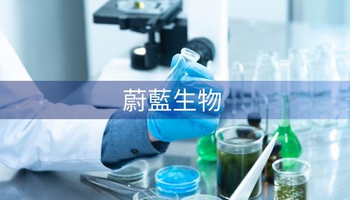 一個(gè)案例告訴你,精細(xì)化管理為何先從財(cái)務(wù)下手